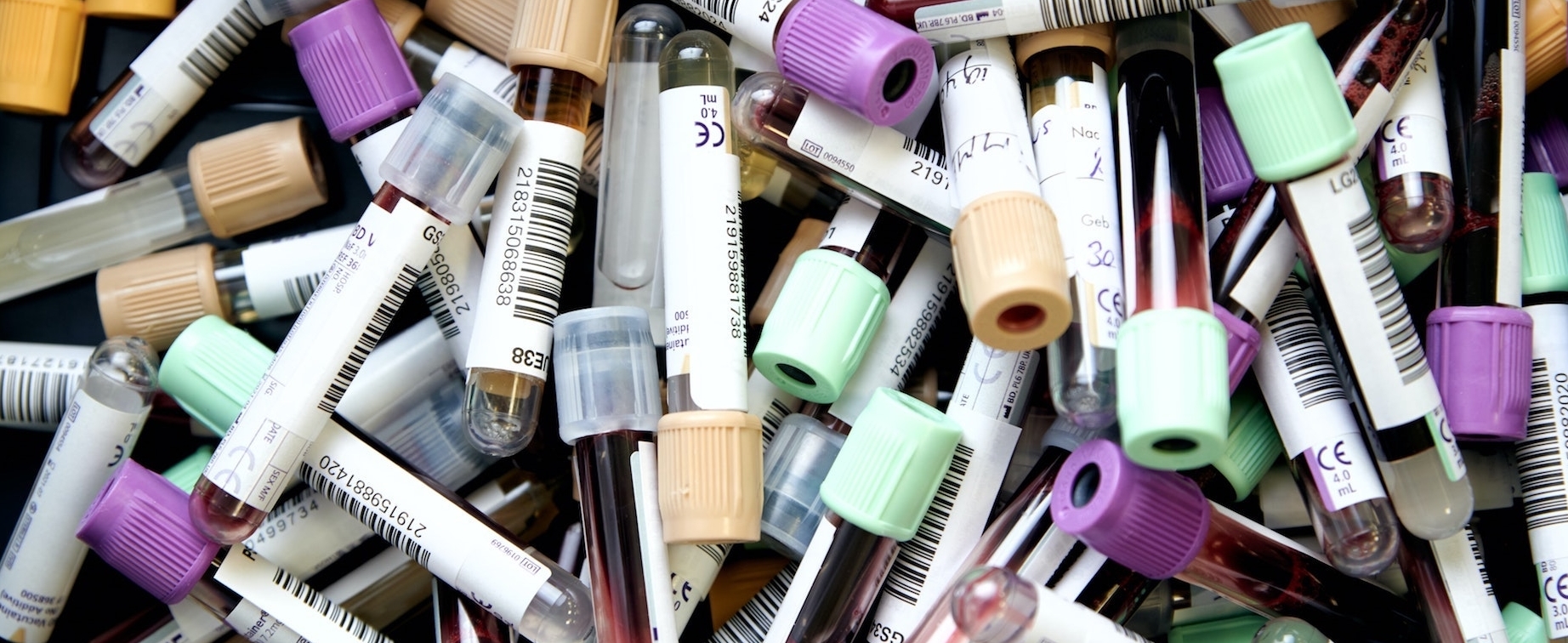 What are the Types of Blood Thinners and How do they Function in the Body?