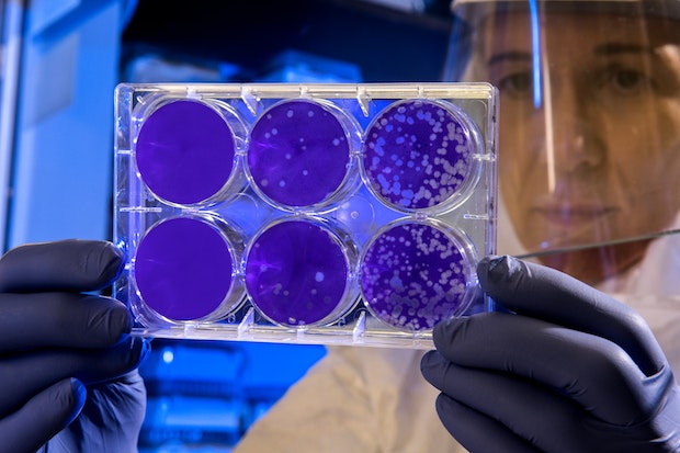 a scientist looking at slides of microbial swabs